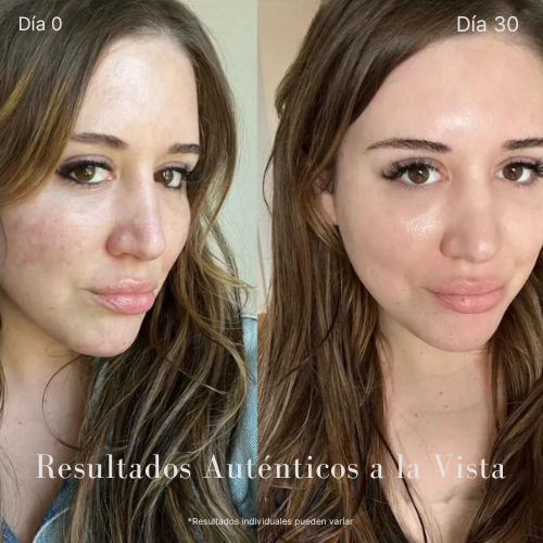 MerciGlow™ - Bio-Collagen Mask