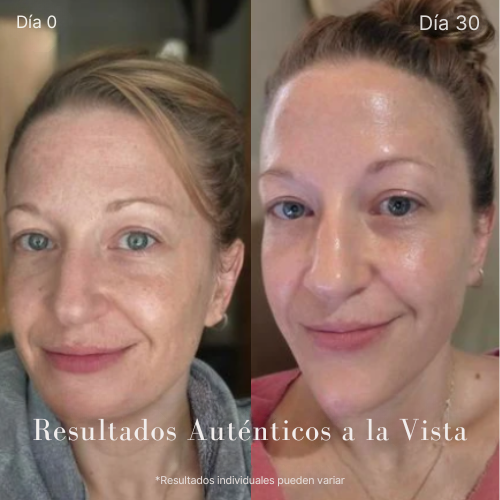 MerciGlow™ - Bio-Collagen Mask